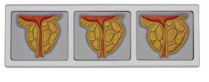 GPI Anatomicals® Male Pelvis with 3D Prostate Frame Model