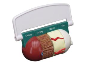 GPI Anatomicals® 4-Piece Diabetes Model