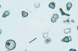 Radiolaria Strew Slide