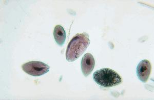 Rumen, Ciliates Slide