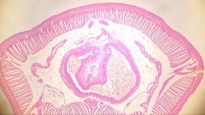 Earthworm, Intestinal Region