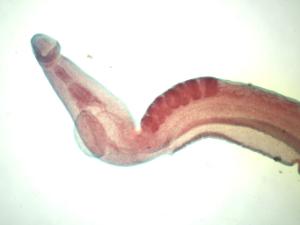 <i>Schistosoma japonicum</i>, Male Slide