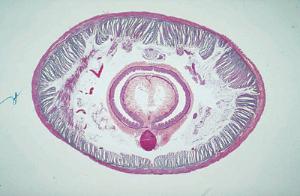 Earthworm, Posterior Slide