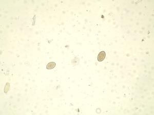 Diphyllobothrium latum, Eggs Slide