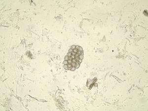 Dipylidium caninum, Egg Slide