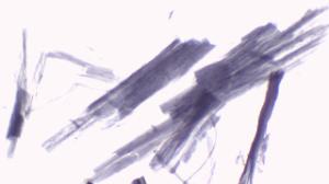 Skeletal muscle, teased preparation slide