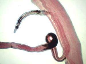 <i>Schistosoma japonicum</i>, Male/Female Slide