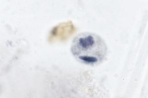 Entamoeba histolytica, Cysts Slide