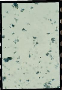 <i>Chilomastix mesnili</i>, Trophozoites Slide