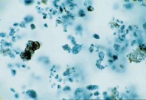 <i>Giardia lamblia</i>, Trophozoites Slide