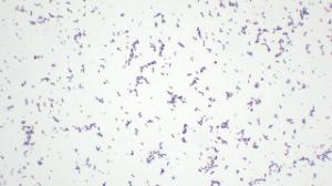 Saccharomyces, sporulation slide