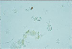 <i>Eimeria sp</i>., Oocysts Slide