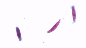 Paramecium, four types