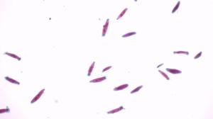 Paramecium, four types