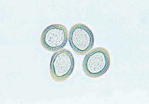 Taenia pisiformis, Eggs Slide