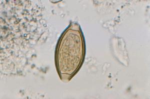 Trichuris trichiura, Eggs Slide