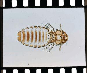 Trichodectes, Adult Slide