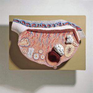 Somso® Ovary Model