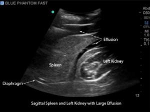 Fast µltrasound training model