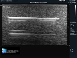 Foreign body identification µltrasound training model