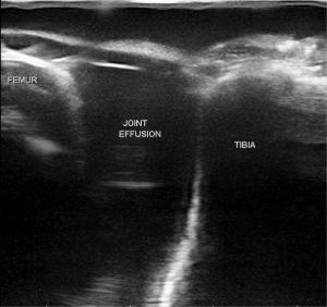 Msk knee µltrasound training model