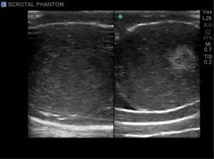 Scrotal µltrasound training model