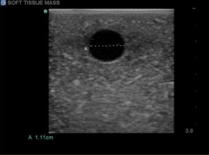 Soft tissue biopsy µltrasound training block model