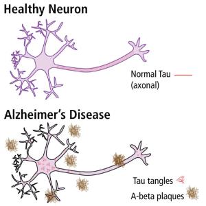 Neuron comparison