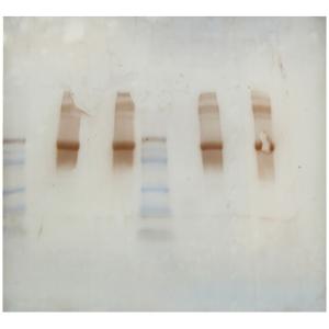 Western blot