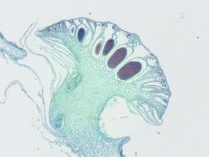 <i>Marchantia</i>, Antheridia Slide