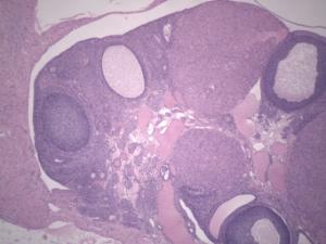 Ovary, Corpus Luteum Slide