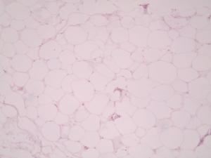 Adipose Tissue