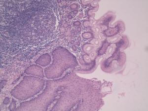 Esophagus-Stomach Junction, Primate Slide