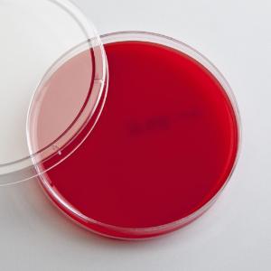 Prepared Blood Agar Media