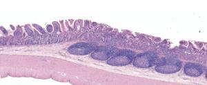 Ileum, Peyer’s Patches Slide