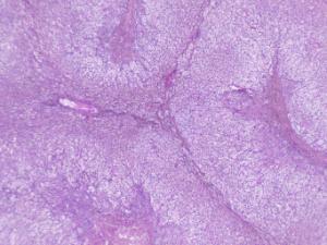 Adrenal Gland, Human Slide