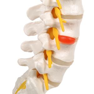 Lumbar Spinal Column