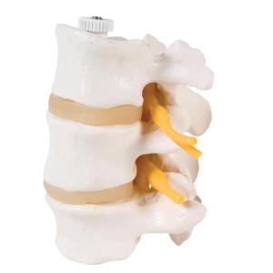 Lumbar Vertebra Flex Mount