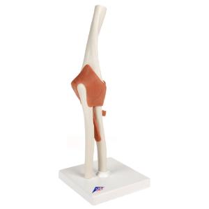 Functional Elbow Joint