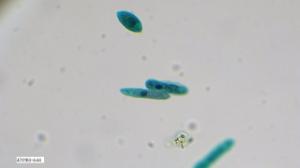 <i>Euglena sp.</i>