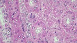 Simple squamous mesothelium