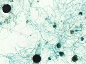 Rhizopus, Sporangia and Zygotes Slide