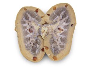 Preserved Pig Kidney with Polycystic Kidney Disease