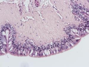 Simple Ciliated Columnar Epithelium