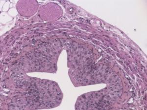 Transitional Epithelium Slide