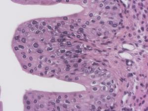 Transitional Epithelium Slide