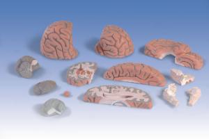 3B Scientific® Giant Brain