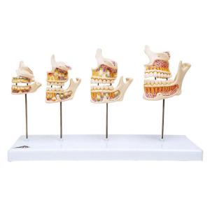 3B Scientific® Dentition Development Set