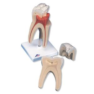 3B Scientific® Classic Tooth Models