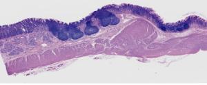 Stomach and  Duodenum Slide